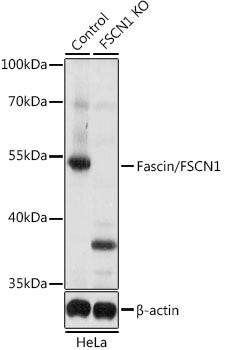 [KO Validated] Fascin/FSCN1 Rabbit pAb