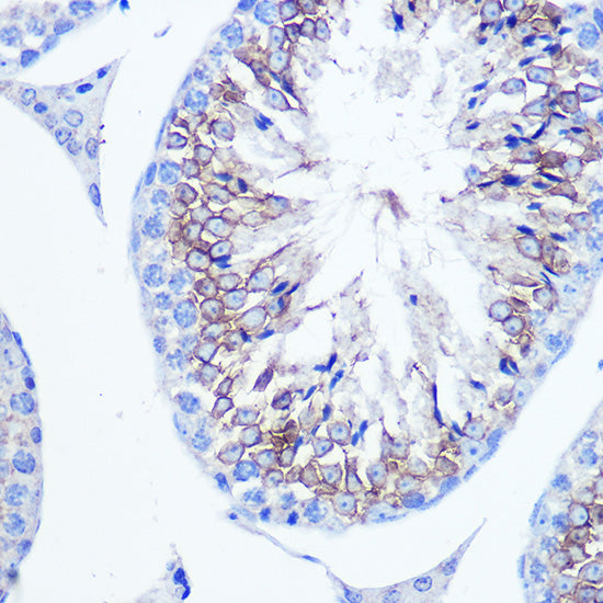 [KO Validated] Fascin/FSCN1 Rabbit pAb