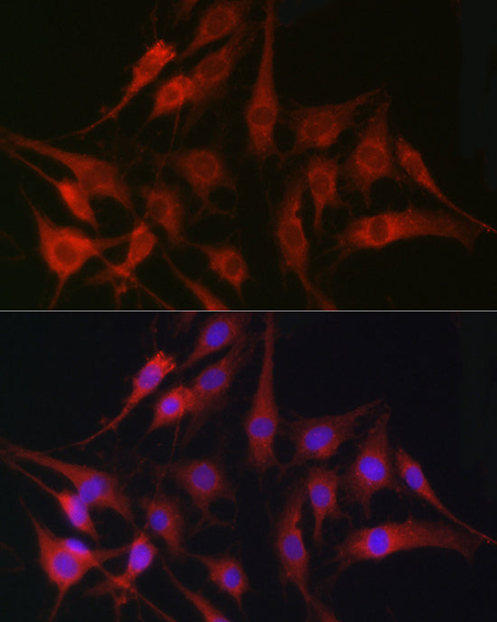 [KO Validated] Fascin/FSCN1 Rabbit pAb