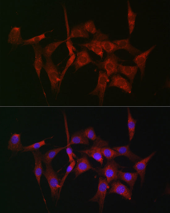 [KO Validated] Fascin/FSCN1 Rabbit pAb