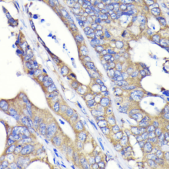 Fatty Acid Synthase (FASN) Rabbit mAb