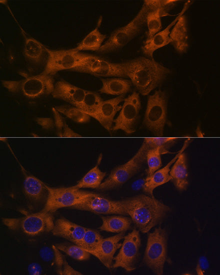 Fatty Acid Synthase (FASN) Rabbit mAb