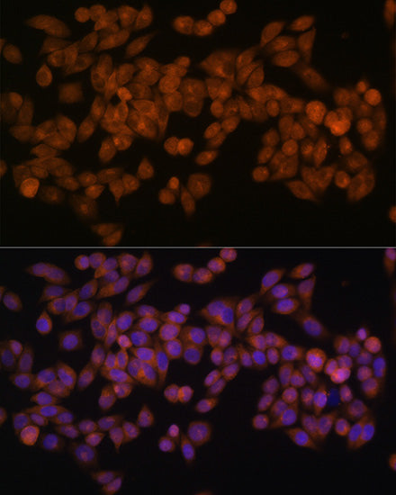 Fatty Acid Synthase (FASN) Rabbit mAb