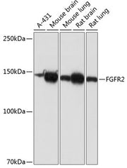 [KO Validated] FGFR2 Rabbit mAb