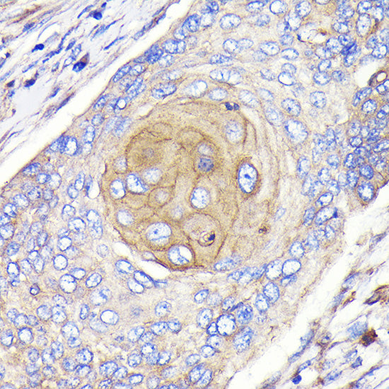 FGFR3 Rabbit mAb