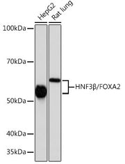 HNF3β/FOXA2 Rabbit mAb