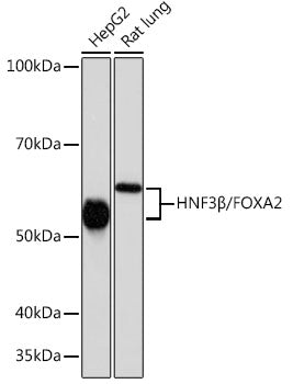 HNF3β/FOXA2 Rabbit mAb