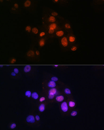 HNF3β/FOXA2 Rabbit mAb