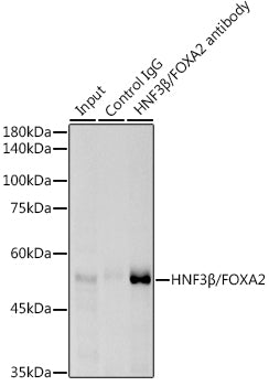 HNF3β/FOXA2 Rabbit mAb