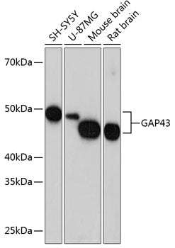 GAP43 Rabbit mAb