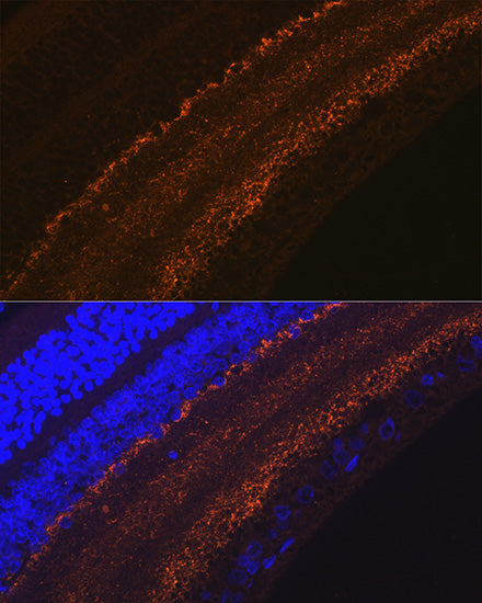 GAP43 Rabbit mAb