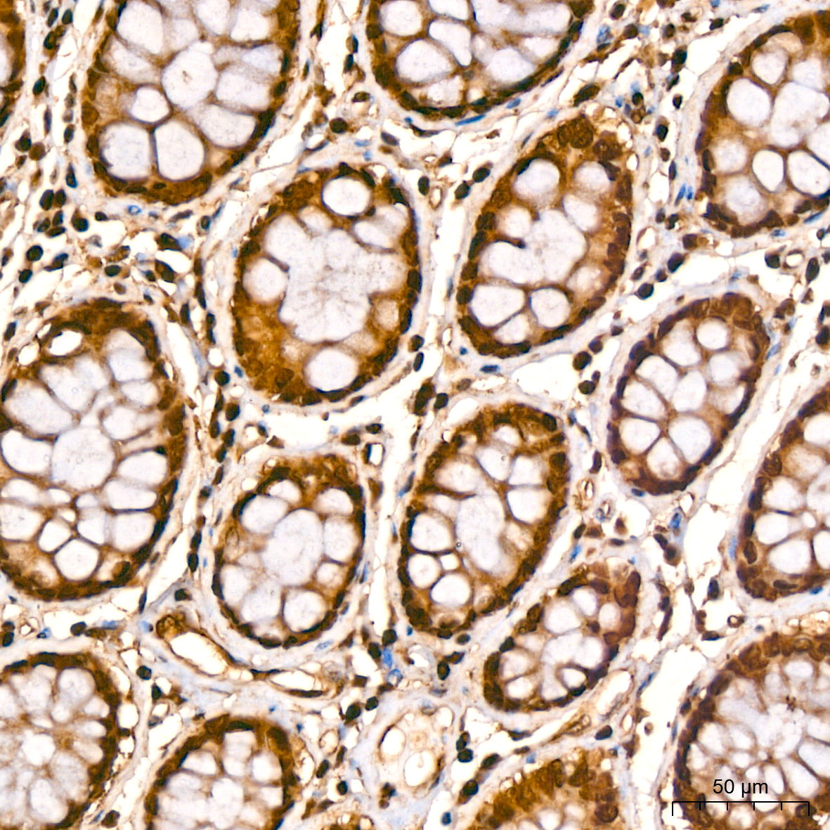GAPDH Rabbit mAb(High Dilution)
