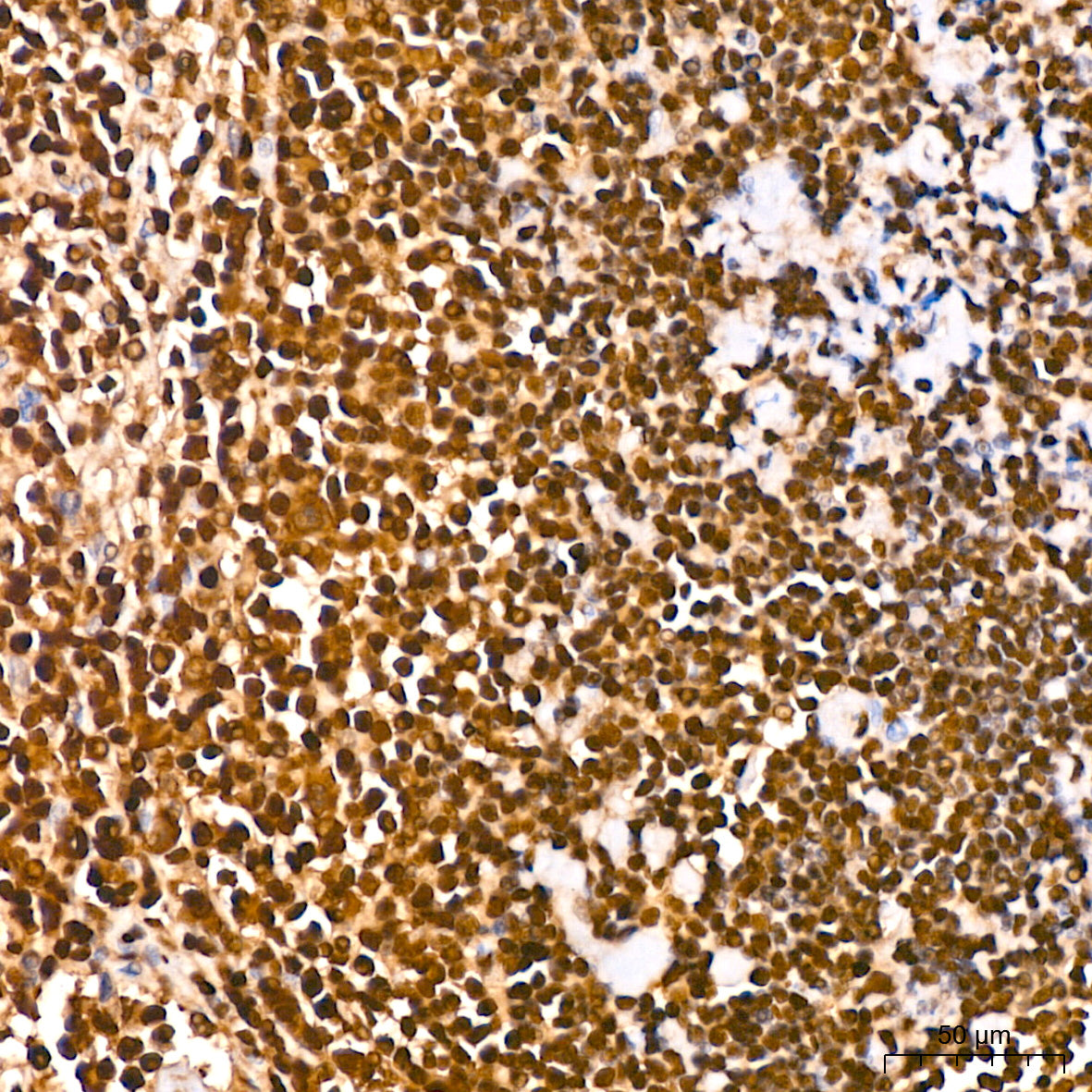 GAPDH Rabbit mAb(High Dilution)