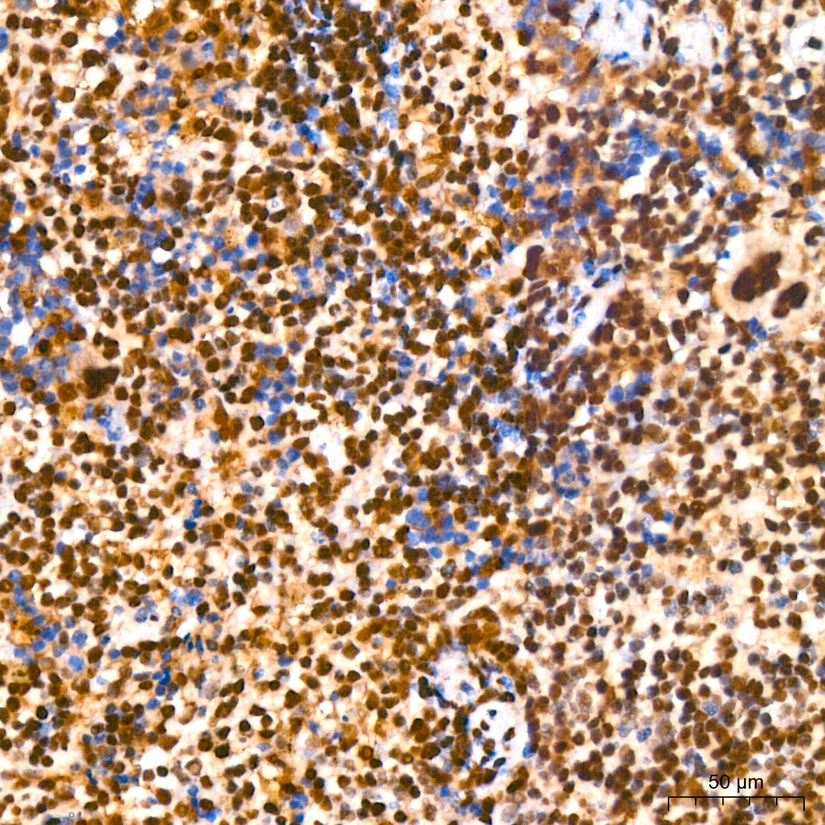 GAPDH Rabbit mAb(High Dilution)