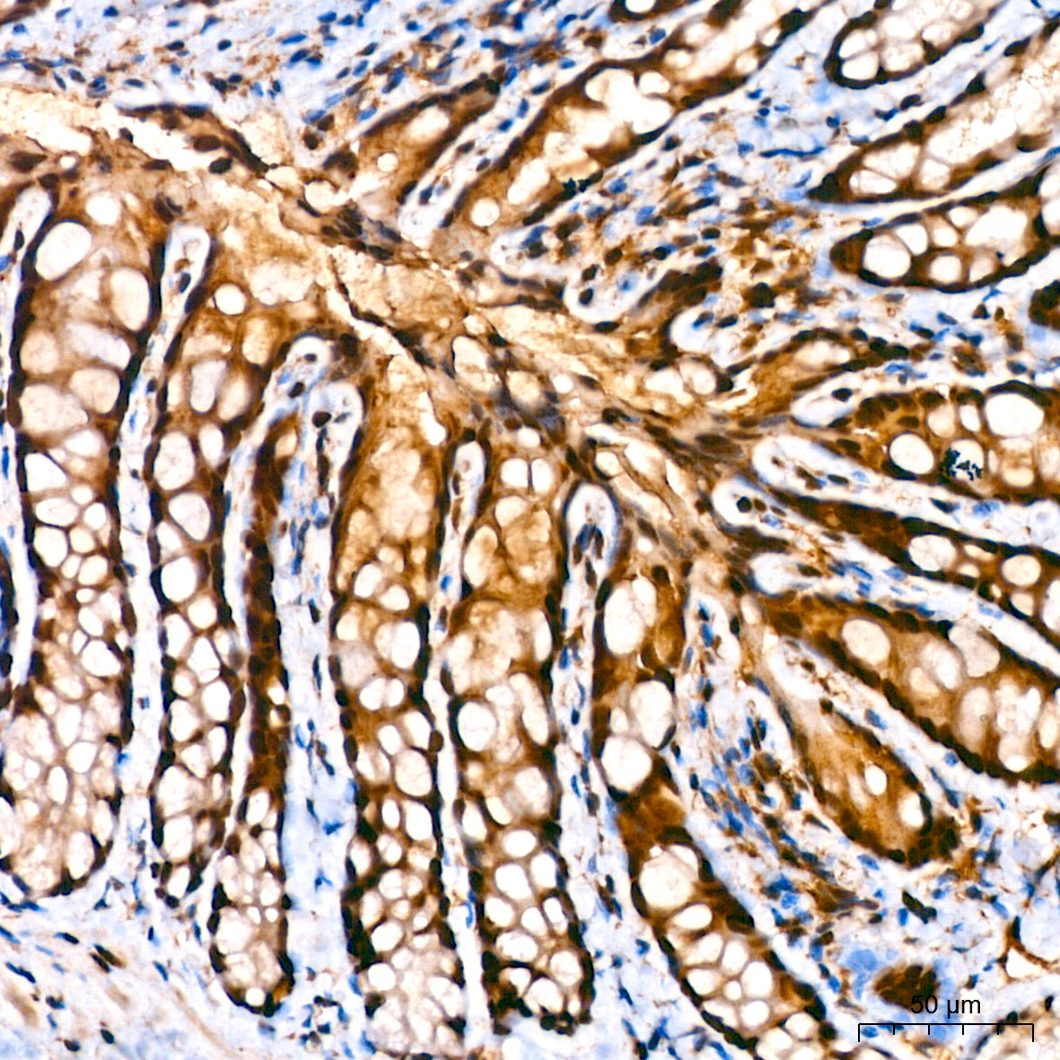 GAPDH Rabbit mAb(High Dilution)
