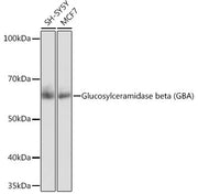 Glucosylceramidase beta (GBA) Rabbit mAb