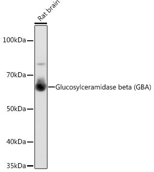 Glucosylceramidase beta (GBA) Rabbit mAb