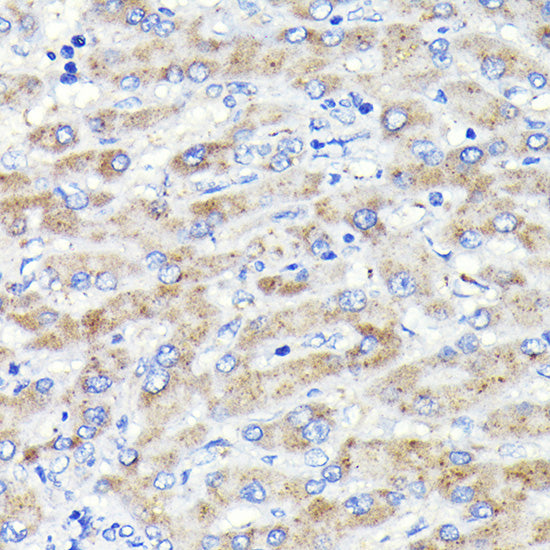 Glucosylceramidase beta (GBA) Rabbit mAb