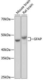 GFAP Rabbit mAb
