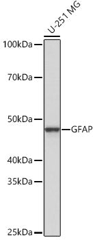 GFAP Rabbit mAb