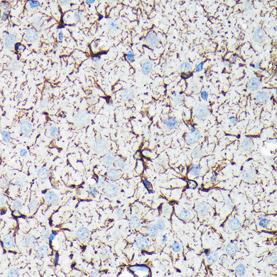 GFAP Rabbit mAb