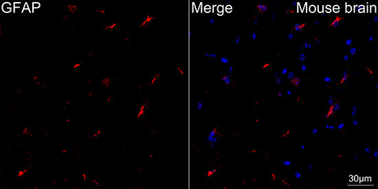 GFAP Rabbit mAb