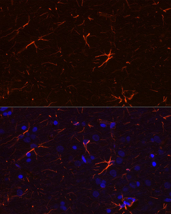 GFAP Rabbit mAb