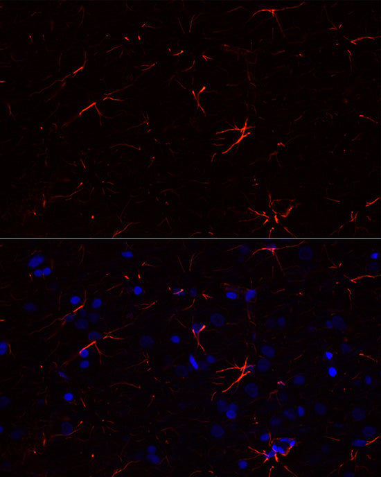 GFAP Rabbit mAb