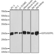 GST3/GSTP1 Rabbit mAb