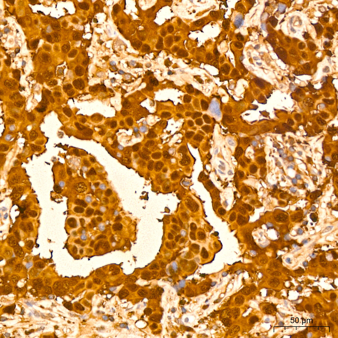 GST3/GSTP1 Rabbit mAb