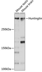 [KO Validated] Huntingtin Rabbit mAb