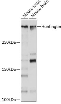 [KO Validated] Huntingtin Rabbit mAb