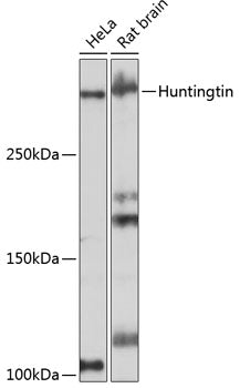 [KO Validated] Huntingtin Rabbit mAb