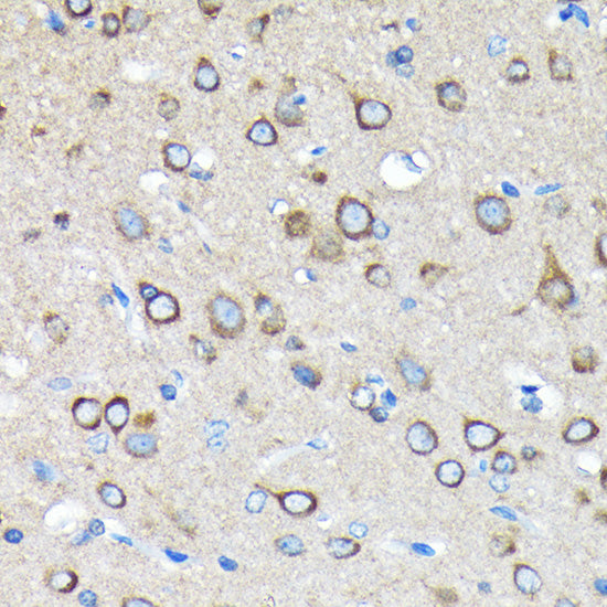 [KO Validated] Huntingtin Rabbit mAb