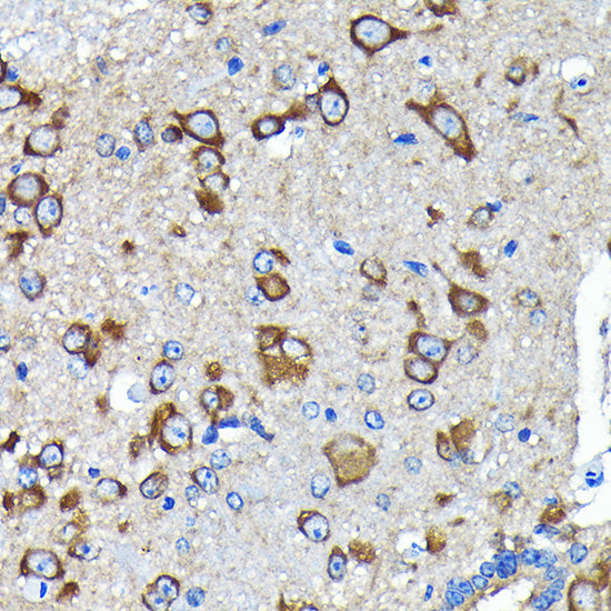 [KO Validated] Huntingtin Rabbit mAb