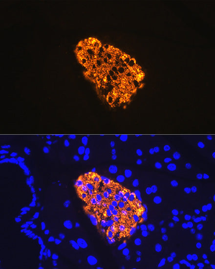 Insulin Rabbit mAb