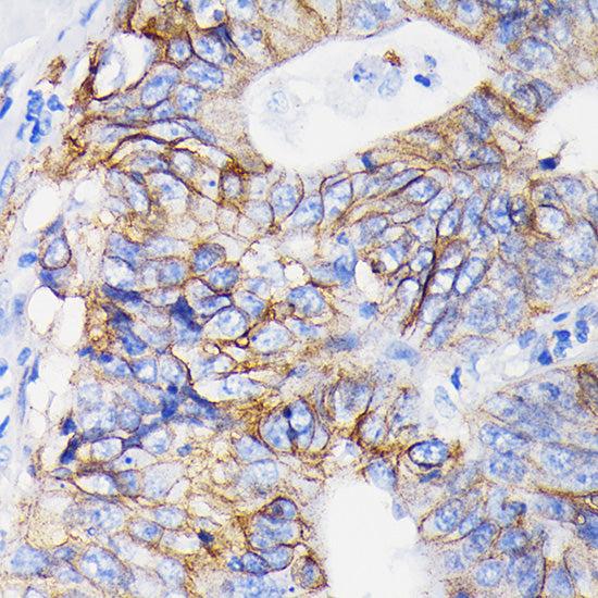 [KO Validated] Integrin alpha 2 (ITGA2/CD49b) Rabbit mAb