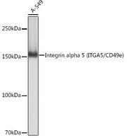Integrin alpha 5 (ITGA5/CD49e) Rabbit mAb