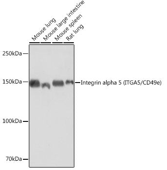 Integrin alpha 5 (ITGA5/CD49e) Rabbit mAb