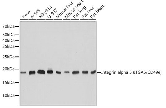 Integrin alpha 5 (ITGA5/CD49e) Rabbit mAb