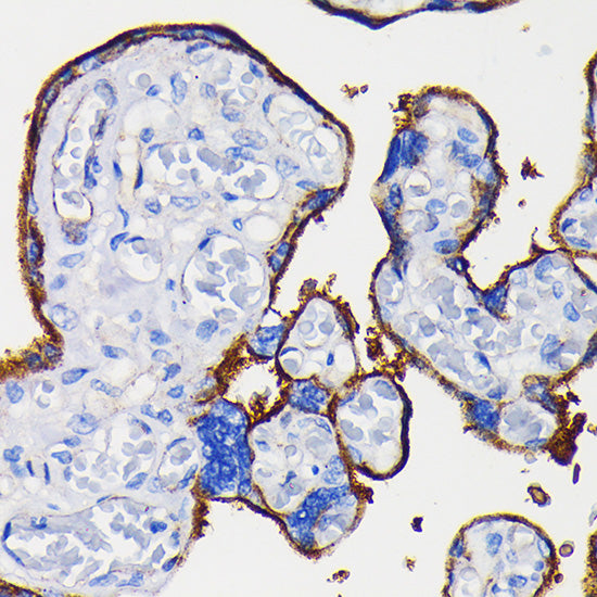 Integrin alpha 5 (ITGA5/CD49e) Rabbit mAb