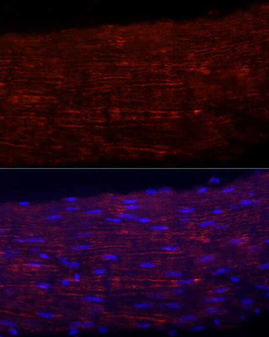 Integrin alpha 5 (ITGA5/CD49e) Rabbit mAb