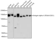 Integrin alpha V (ITGAV/CD51) Rabbit mAb
