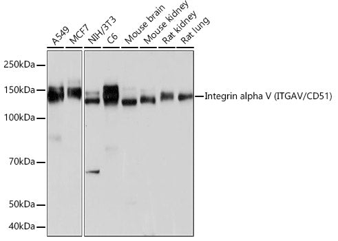 Integrin alpha V (ITGAV/CD51) Rabbit mAb