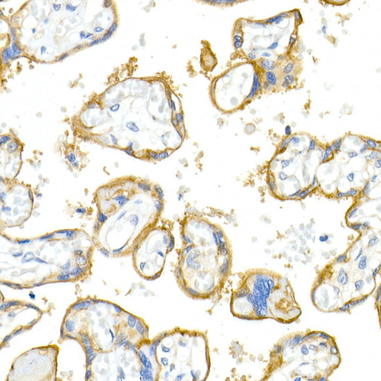 Integrin alpha V (ITGAV/CD51) Rabbit mAb