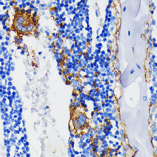 Integrin beta 3 (ITGB3/CD61) Rabbit mAb