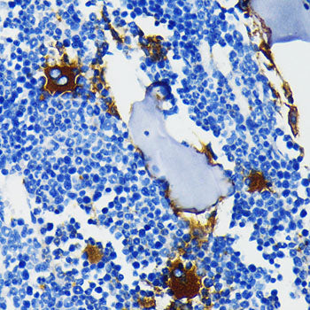Integrin beta 3 (ITGB3/CD61) Rabbit mAb