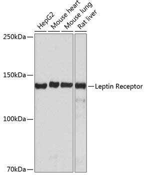Leptin Receptor Rabbit mAb