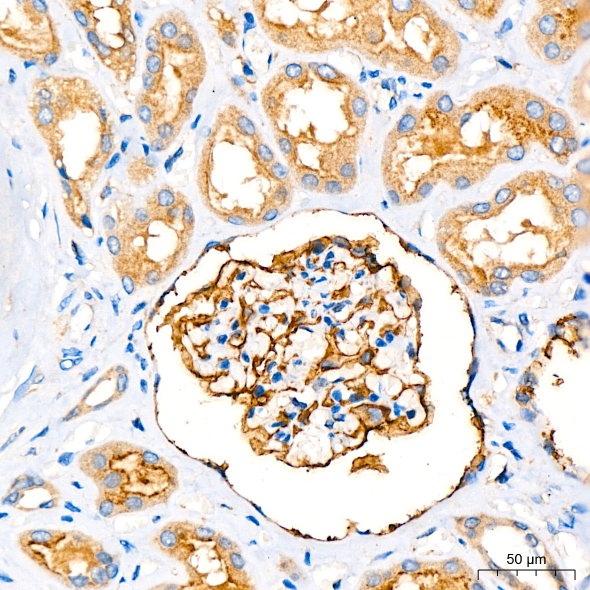 Leptin Receptor Rabbit mAb