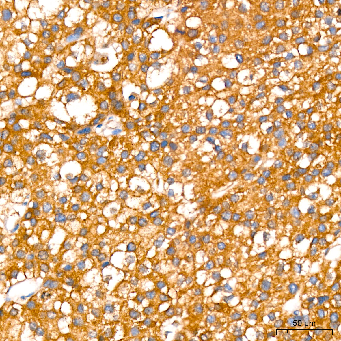 Leptin Receptor Rabbit mAb